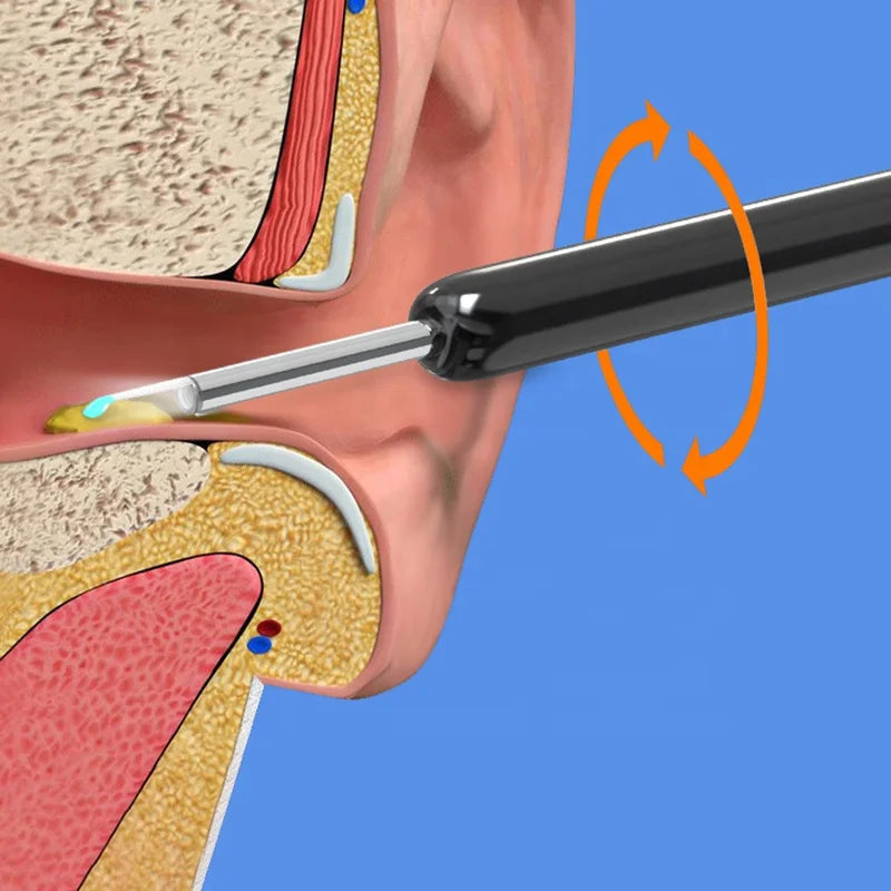 Smart Wireless Visual Ear Cleaner High Definition Otoscope Ear Pick Luminous Ear Wax Removal Tool with Camera